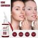 Fruit Acid Salicylic Acid Essence Fruit Acid Serum Salicylic Acid Serum Salicylic Acid Acne Treatment to Rejuvenate Skin Remove Acne Control Oil and Shrink Pores 30ml - Buy Online on GoSupps.com