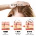 Castor Oil for Hair - Castor Oil Cold Pressed | Natural Hair Growth Oil with Castor | Strengthening Nourishing Hair Regrowth Oil | Hair Thickening Oil 30ml Promotes Longer Thicker Hair - Buy Online on GoSupps.com