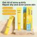Skincare Set for Acne Prone Skin Anti Acne Skin Care Sets & Kits Skincare Gift Set with Cleanser- Serum- Essence Gel- Mask*2 Acne Remove Oil Control Facial Kit Hydrate Shrink Pore Sooth Redness - Buy Online on GoSupps.com