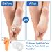 12 Sheet Round Foot Callus Pads | Soft Adhesive Cushion for Men & Women | Relieve Soreness & Protect Toes - International Shipping Available - Buy Online on GoSupps.com