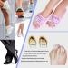 Eufance Gel Toe Separator for Hallux Valgus Correction | Pain Relief for Yoga & Sports | 2 Pairs (4 Pieces) - Perfect Nail Pedicure Manicure Tool - Buy Online on GoSupps.com