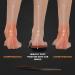 (New 2023) Balance Arch Support Insoles for Plantar Fasciitis Relief - Shock Absorbing Orthotic Insoles - Men Women S(Men 5.5-6.5/Women 6.5-7.5 - Buy Online on GoSupps.com