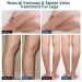 Varicose Veins Cream for Natural Treatment - Strengthen Capillary Health, Improve Blood Circulation - 20g - Buy Online on GoSupps.com