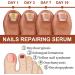 GFOUK 7 days Nail Growth and Strengthening Serum for Thin Nails Nail Growth and Strength Serum Nail Cuticle Oil Strengthener Stronger Nails in 1 Week Nail Strengthening Treatment (2 pcs) - Buy Online on GoSupps.com