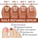 GFOUK 7 Days Nail Growth and Strength Serum Set - Nail Repair and Growth Oil for Toenail Treatment (2 Pcs) - Buy Online on GoSupps.com