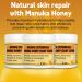 Buy Manuka Honey Eczema Balm - Soothing Relief for Psoriasis Rashes & Itchy Skin - Natural Remedy for Adults & Children - Buy Online on GoSupps.com