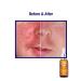 Pro-Heal Serum Advance+ | Antioxidant-rich Vitamin C, E & Retinol for Redness, Rosacea & Inflammation - Buy Online on GoSupps.com