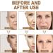 (100% 5 star) Rapid Anti Wrinkle Cream Wrinkle Filler for Deep Wrinkles Instantly | Wrinkle Cream for Men and Women | Wrinkle Cream | Deep Wrinkle Cream | Anti Wrinkle Face Cream | Anti Aging Cream - 50ml/1.7fl.oz (2pcs Rapid Anti Wrinkle Cream) - Buy Online on GoSupps.com