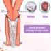 300ml Vaginal and Anal Douche Cleaner Kit - 3 Nozzle Tips, Reusable Manual Enema for Water Colon Cleansing - Perfect Gift for Women (300ml/10.1oz) - Buy Online on GoSupps.com