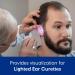 Bionix 2200 Light Source for Lighted Ear Curette System - Ideal for Earwax Removal - Healthcare Provider's Choice (Single) - Buy Online on GoSupps.com