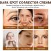 IZBEAUVO Dark Spot Remover for Face Dark Spot Cream Freckle Removal Cream Dark Spot Correcting Glow Serum Dark Spot Corrector Cream Dark Spot Remover Sunspots & Melasma Cream Anti-Aging - Buy Online on GoSupps.com