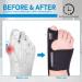 Hallux Valgus Correction Set | Bunion Corrector for Men & Women | Gel Toe Spreader & Separator for Overlapping Toes - Buy Online on GoSupps.com