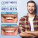 CustMbite Premium Teeth Whitening Gel 16% Carbamide Peroxide - 5 Pack (3ml Applicators) - Buy Online on GoSupps.com