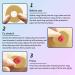 Ostomy Barrier Rings for Better Seal | 24mm Outer Diameter & 2mm Thickness | Box of 10 - Buy Online on GoSupps.com