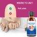Extra Strength Toenail Fungus Treatment - Nail Repair Solution for Discolored Nails - Renew Damaged Toenails - Fingernail & Toenail Fungus Treatment - Buy Online on GoSupps.com