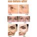 2 Minutes Instantly Eye Bag Removal Long Lasting Effect Puffiness Wrinkles Fine Lines Remove For Eyes For The - Buy Online on GoSupps.com