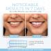 Bloom Teeth Whitening Kit | Fast Acting 35% Carbamide Peroxide Gel + 5X LED Light | Whiten Teeth in 10 Minutes | No Sensitivity with Coconut Oil & Hydroxyapatite - Buy Online on GoSupps.com