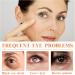 Vitamin C Eye Cream For Dark Circles Vitamin C Eye Cream Anti Aging Vitamin C Brightening Eye Cream For Brighten Skin Around the Eyes Eye Cream Targets Fatigue Dullness And Crow'S Feet - Buy Online on GoSupps.com