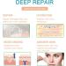 Silicone Scar Sheets 1.6 x 60 - Medical Grade Soft Silicone Tape for Easy Scar Removal - Comfortable & Pain-Free - Buy Online on GoSupps.com