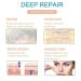 Silicone Scar Tape Roll for Surgery Scars - Easy Tear Removal - 1.6x120 - Medical Grade Soft Silicone Sheets - Buy Online on GoSupps.com