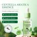 BIOAQUA Centella Asiatica Serum - Soothing Repair Oil Control & Anti-Acne Skin Care - 30ml - Buy Online on GoSupps.com
