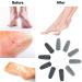 10 PCS Flawless Pedi Replacement Heads for Finishing Touch/Amope Electric Pedicure Roller Refills - Buy Online on GoSupps.com