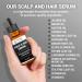 Dr. Berg Scalp & Hair Serum Improved Formula with Vitamin D3 & E - Clinically Tested Free Hair Oil for Women & Men - 2 Fl Oz - Buy Online on GoSupps.com