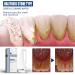 Effective Tartar & Yellowed Teeth Mouth Spray - Long-Lasting Freshness | International Shipping - Buy Online on GoSupps.com