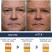 Hixideli Awaken Peptide Lifting Eye Gel 2pcs Set - Men's Anti-aging Firming Eye Cream - Buy Online on GoSupps.com