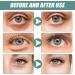 1 Pcs Jasmine Eye Cream Jasmine Ointment For Dark Circles Jasmine Active Ointment Jasmine Eye Cream Reduces Dark Circles Fine Lines Bags And Wrinkles Under The Eyes - Buy Online on GoSupps.com