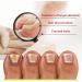 Anti-Fungal Nail Treatment Kit with Nail Clippers & Glass Nail File - Natural Ingrown Toenail Correction & Fungal Nail Repair - 2 in 1 Nail Care Solution - Buy Online on GoSupps.com