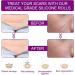 Silicone Scar Sheets 1.6x60 inches - Clear Silicone Scar Tape for Scar Removal - Suitable for Variety of Scars - Scar Away Upgrade - Buy Online on GoSupps.com