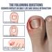 German Toenailcare Removal Paronychia Oil - Repair Damaged Discolored Thick Nails - 2 Pcs - Buy Online on GoSupps.com