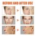 2023 Youthfully Botox Face Serum - Anti-Wrinkle, Anti-Aging, Dark Spot Corrector - Collagen Infused (1 Pcs) - Buy Online on GoSupps.com