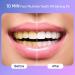 MySmile Deluxe 10 Min Teeth Whitening Kit with 28 LED Light - 16 Fl Oz. - Buy Online on GoSupps.com