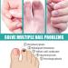 Fungal Nail Serum Pen with Tea Tree Oil and Aloe - Extra Strong Treatment for Toenails and Fingernails - Improve Damaged Nails - 1PCS - Buy Online on GoSupps.com