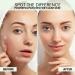 Buy Pimple Patches for Face - 108 Hydrocolloid & Hazel Acne Dots - Fast Acting Treatment (8mm & 12mm) - International Shipping Available - Buy Online on GoSupps.com