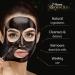 7th Heaven Renew You Blackhead Detox Deep Pore Cleansing Peel Off Mask Black Clay and Witch Hazel 0.021 Kg - Buy Online on GoSupps.com