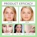Nettoyant Visage Moussant L'aloe Vera - Nettoie En Douceur Les Pores Hydrate (sans Tiraillements) limine Impuret s L'acn Et Points Noirs For Une Peau Nette(1PCS) 1 g (Lot de 1) - Buy Online on GoSupps.com