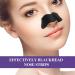 Blackness Nose Strips - 50PC Activated Carbon Pore Strips for Blackhead Removal & Deep Cleansing | Anti-Blackhead Solution - Buy Online on GoSupps.com