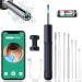 Ear Wax Removal Tool SANKTON Ear Cleaner with 1080P HD Camera Earwax Remover with Light Endoscope with a Retractable Design Otoscope for iPhone iPad Android Phones & Pads (Titanium Black)
