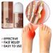 AAOCLO 2pcs Anti Bunion Treatment Oil Pain Relief Roller - Foot Care Corrector for Women & Men - Pro Health Solution - Buy Online on GoSupps.com