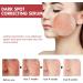 Dark Spot Correcting Serum Peach 70% Niacinamide Serum for Acne Scars Post-Acne Marks Korean Skincare Set for Teenagers Adult - Buy Online on GoSupps.com