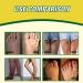 Gingerlegs Anti Swelling Ointment 20g Ginger Anti Cellulite Ointment Anti Cellulite Firming Cream for Legs Antiswelling Lympunclog Ointment Mediginger Anti Swelling Cream - Buy Online on GoSupps.com