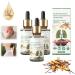 1/2/3Pcs Cordyceps Sinensis Extract - Lung Clearing Drops - Clean & Breathe Cordyceps Sinensis Herbal Lung Cleanse Spray-for Lung Discomfort 4 Weeks to Improve Clean Lungs 30ml/1fl.oz (3pcs)