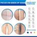 Varicose Veins Relief Cream - Fast Treatment for Legs | Improve Blood Circulation | Phlebitis & Angiitis Inflammation Relief - Buy Online on GoSupps.com