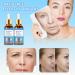 2023 Botox Stock Facial Solution + Jennifer Aniston Anti-Aging Serum + Dark Spot Corrector - 3pc Set - Buy Online on GoSupps.com