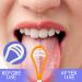 Kasesss 5-Piece Tongue Cleaner Set Plastic Tongue Scrapers in 5 Colors for Adults & Children | Fresh Breath & Bad Breath Fighter - Buy Online on GoSupps.com