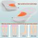 Shop O/X Leg Orthopedic Insoles - Supination & Flat Feet Arch Support | Size 38 for Foot Alignment & Knee Pain Relief - Buy Online on GoSupps.com