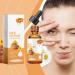 Gouttes Lubrifiantes Pour Les Yeux | 30ml Hydratantes Gouttes Oculaires | Soulagement Fatigue Oculaire S cheresse Hydratant Sympt mes | Taille Voyage Femmes Filles - Buy Online on GoSupps.com